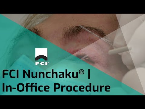 FCI Nunchaku® | In-Office Procedure | Exclusive | FCI Lacrimal