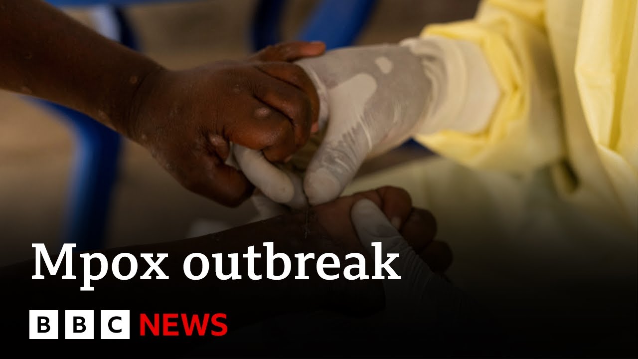 Mpox declared public health emergency in Africa | BBC News