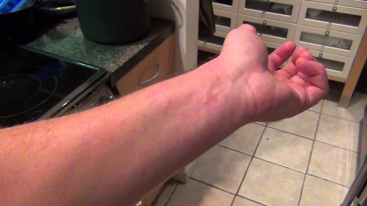 ringworm-and-eczema-nail-polish-cure-part-2-youtube