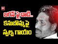 జగన్ ఫై దాడి .. కనుబొమ్మపై స్వల్ప గాయం | Attack On CM Jagan | 99tv