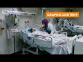 GRAPHIC WARNING - Gaza doctor: Were performing surgeries in corridors