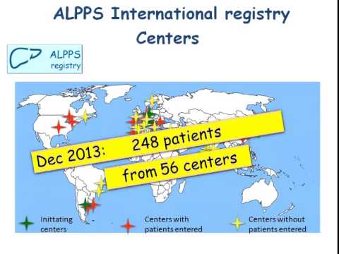ALPPS: Past, Present and Future 