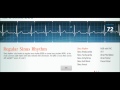 Easy EKG: Interpreting Rhythms