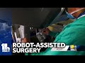 Robot-assisted heart surgery saves mans life