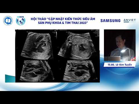 Các bất thường tim thai thường gặp (TS.BS. Lê Kim Tuyến)