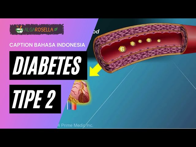 Mengenal Diabetes Tipe 2