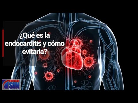 ¿Qué es la endocarditis y cómo evitarla?