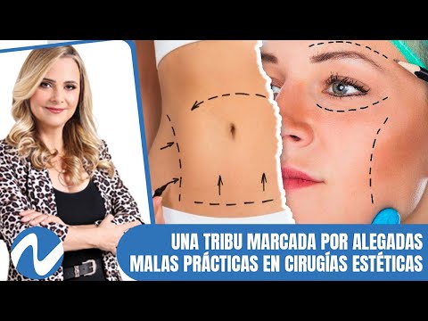 Una tribu marcada por alegadas malas prácticas en cirugías estéticas | Nuria Piera