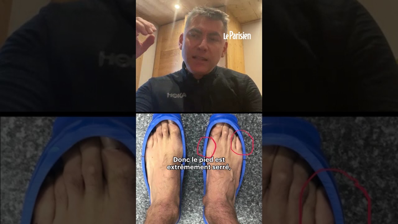 La dure vie des pieds « compressés » des skieurs