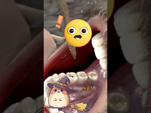 แมงกินฟันที่น่ากลัว!