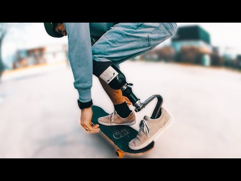 Skater with an INCRDIBLE SUSPENSION PROSTHETIC LEG
