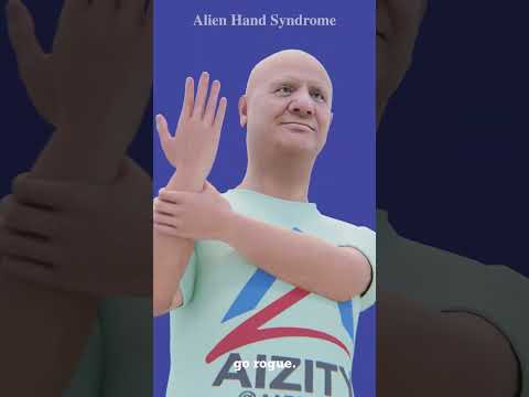 What if Your Hand Can Have Its Own Mind #brain #medical #biology #science #health #neuroscience