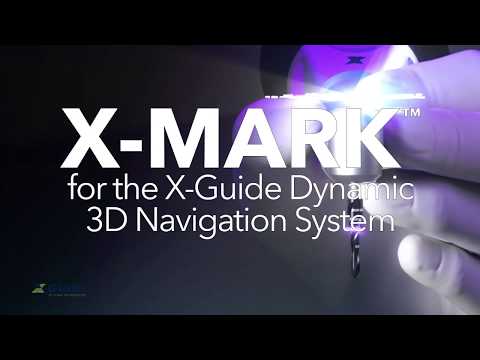 X-Mark Virtual-Based Dental Implant Surgery X-Mark Virtual-Based Dental Implant Surgery