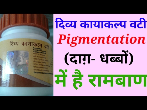 Perfect Treatment of Skin Pigmentation(Dark spots, black patches). Divya Kayakalp Full Review
