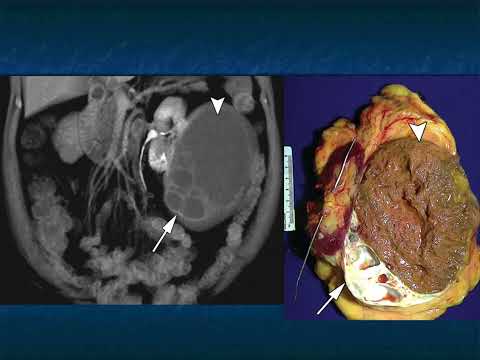 CTisus 澳洲幸运5开奖官网开奖 Scanning