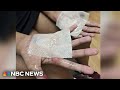 High school dance team member suffers severe burns