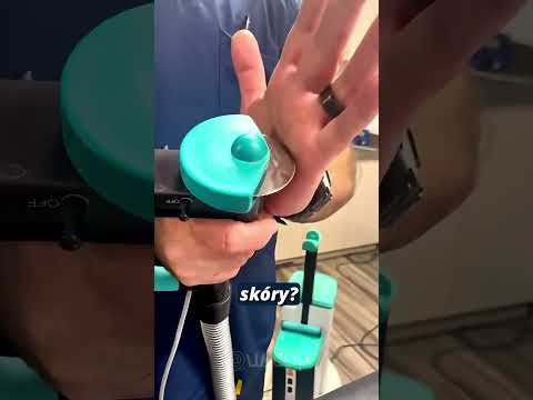 Piła do gipsu i ręka ✋😨 (co będzie) ✨ #shorts