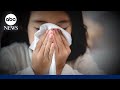 15 pediatric flu deaths in 1 week as total reaches 10,000