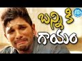 Allu Arjun injured on the sets of 'Sarainodu'