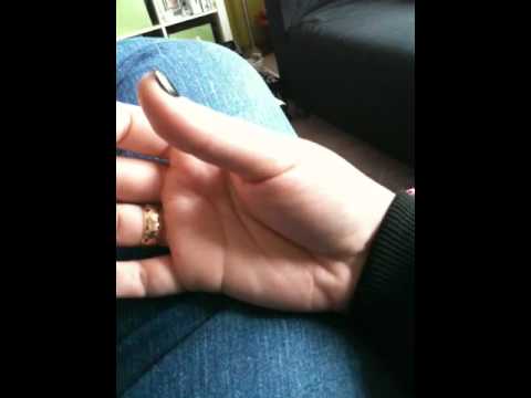 Muscle Spasms Tightness In Hands 67