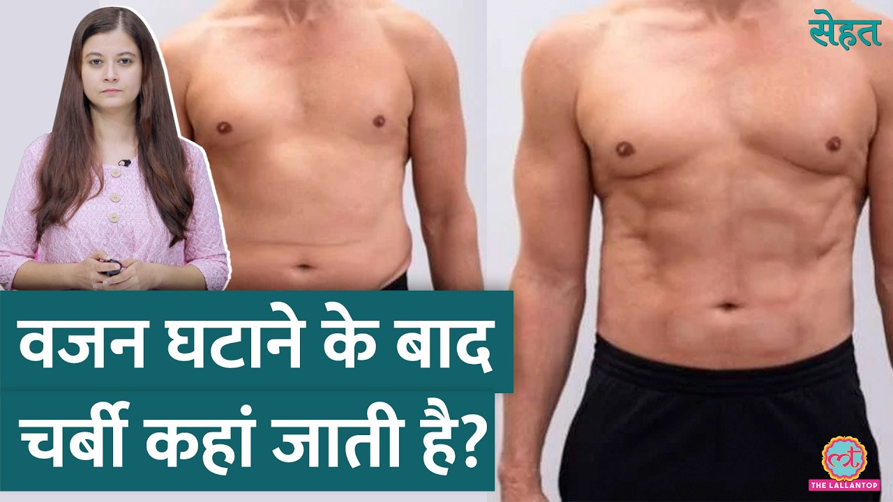 Weight Loss के बाद शरीर से Fat यानी चर्बी कहां जाती है और बाहर कैसे निकलती है? | Sehat ep 965