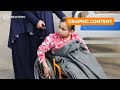 GRAPHIC WARNING: Gazas generation of child amputees lack expert care | REUTERS