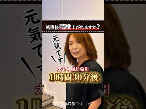 【術直後階段上がれますか？】#美容整形 #脂肪吸引 #整形