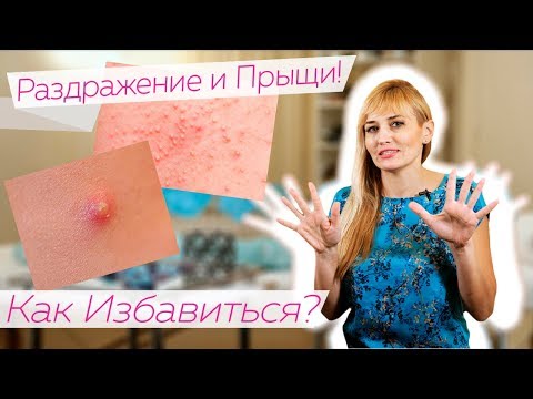 Раздражение и Прыщи после ЭПИЛЯЦИИ / КАК ИЗБАВИТЬСЯ?