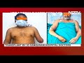 Delhi Painter Hands Surgery | Magic In Operation Theatre, And This Painter Will Paint Again  - 02:00 min - News - Video