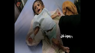 وزارة الصحة اليمنية: عدد ضحايا الحرب أكثر من 40 ألف -