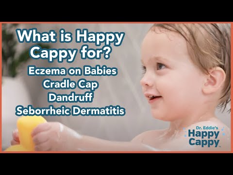What is Happy Cappy for? Eczema on Babies | Cradle Cap | Dandruff | Seborrheic Dermatitis