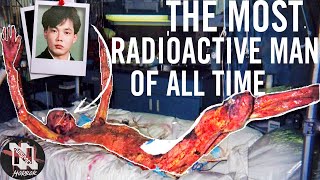 *GRAPHIC* Most Radioactive Man In History | 83 Days Of Pain & Torture | The Death of Hisashi Ouchi