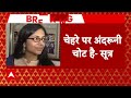 Breaking News: Swati Maliwal के चेहरे पर अंदरूनी चोट- सूत्र | Arvind Kejriwal | AAP | ABP News  - 06:20 min - News - Video