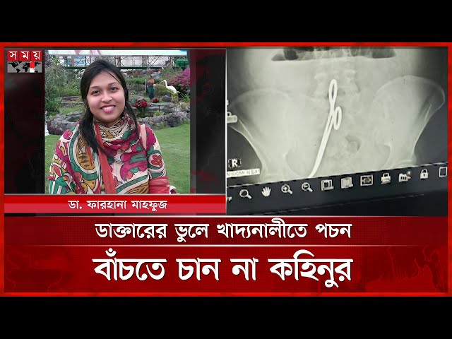 পেটে কাঁচি রেখেই সেলাই করে অপারেশন সফল বলেন ডাক্তার! | Incorrect Operation | Barguna | Somoy TV