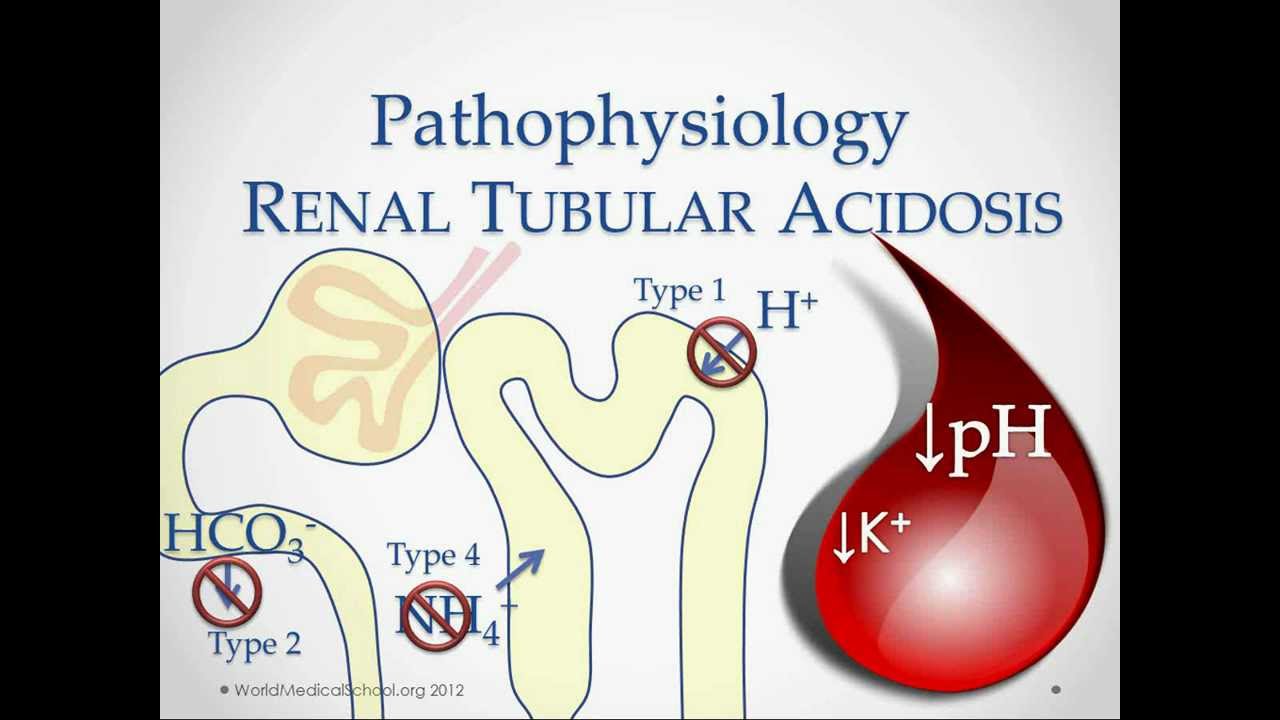 Renal Tubular Acidosis Usmle Step Review Youtube