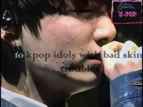 10 Kpop Idols with bad skin troubles.