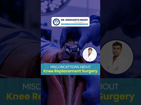 Misconceptions About Knee Replacement Surgery.