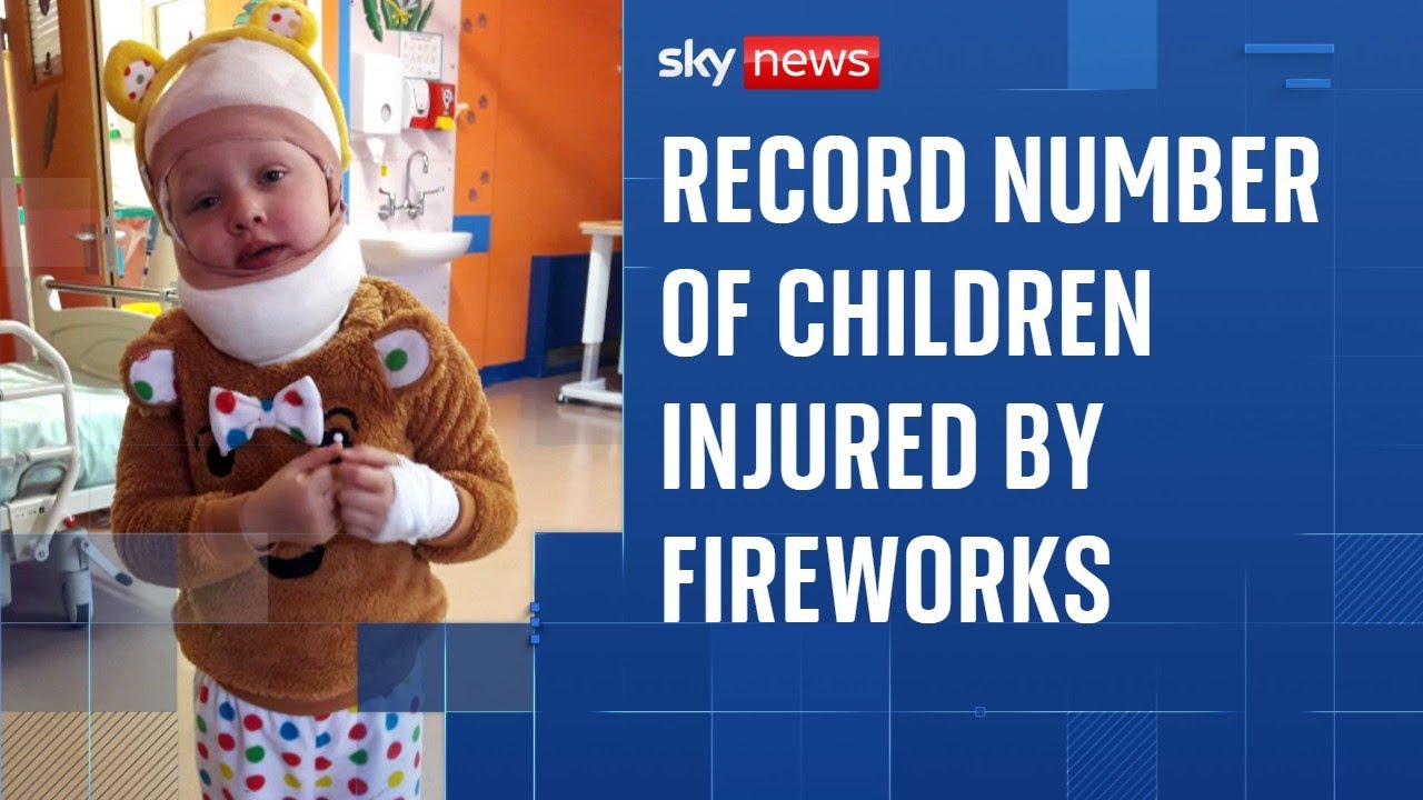 Fireworks injuries among children the highest for a decade