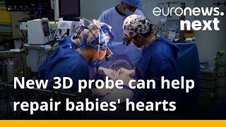 New miniature 3D heart probe can improve open heart surgery in babies
