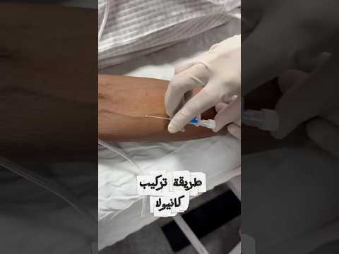 Iv cannulation #nurse