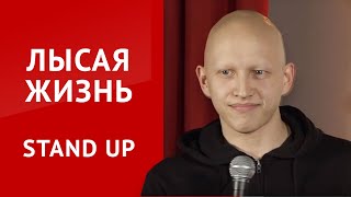 СТЕНДАП Алексей Белобородов | Жизнь без волос