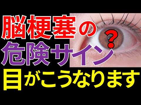【医師監修】見逃すと危険な「脳梗塞が近い人だけに起こる目の異変」