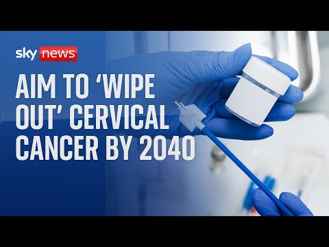 Cervical cancer will be eliminated in England by 2040, NHS pledges