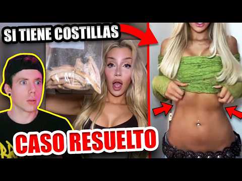 ¡CASO RESUELTO! MUJER se QUITO TODAS sus COSTILLAS y COCINO un CALDO con ellas 💀