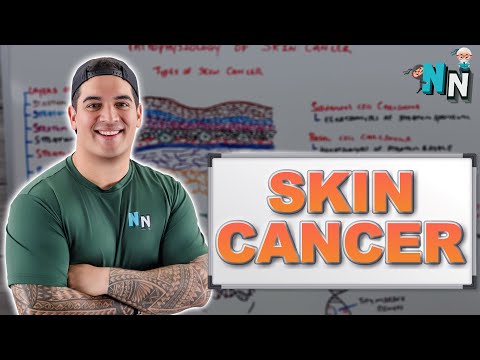 Skin Cancer | Clinical Medicine