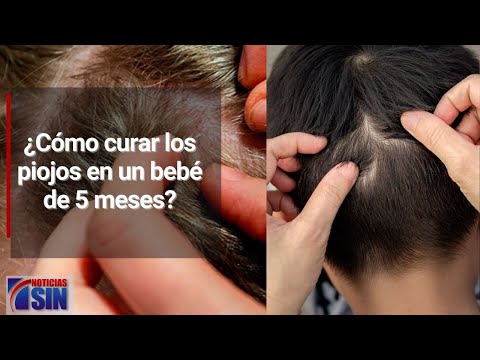 ¿Cómo curar piojos de los niños sin afectarles?