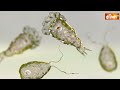 Brain Eating Amoeba केरल में ले रहा लोगों की जानें, देखिए कितना है खतरनाक, क्या हैं लक्षण - 01:40 min - News - Video