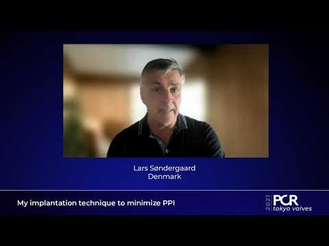 My implantation technique to minimize PPI – PCR Tokyo Valves 2021