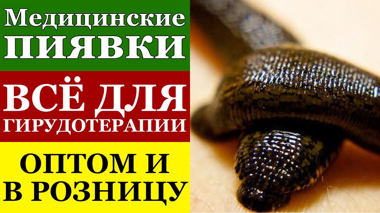 Пиявки Медицинские Купить Казань В Аптеке Цена Пиявки Медицинские Купить Казань В Аптеке Цена