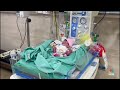 Gaza hospital overwhelmed by hunger and malnutrition among neonates  - 01:42 min - News - Video